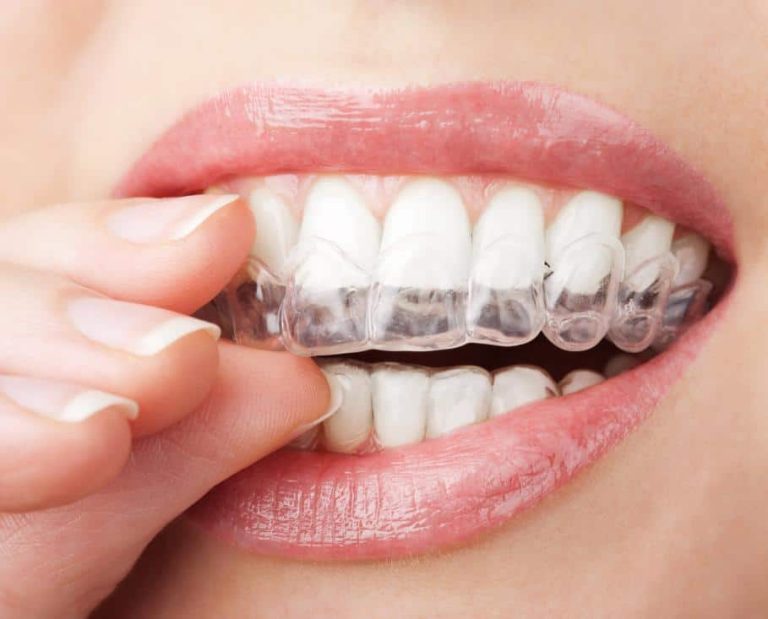 WHITE TEETH
