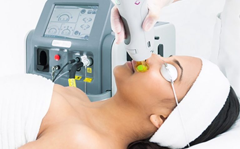 Best Laser Hair Removal Devices