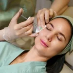 PDRN Injections